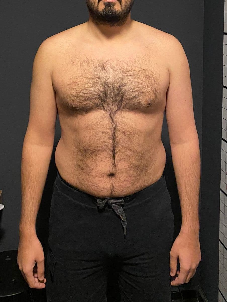 Yusuf Erişmiş - Öncesi