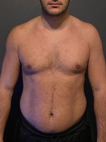 İlker bal - Öncesi